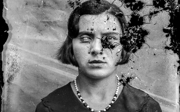 photographie tachée d’une femme à l’oeil voilé